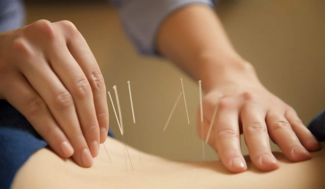 Thuật châm cứu của người xưa vô cùng tinh tế vào “lợi hại”